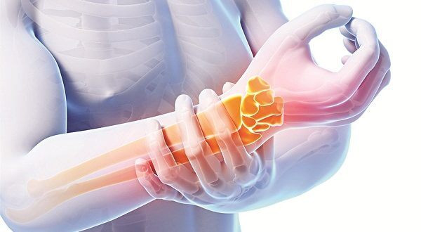 Khi bị đau dây thần kinh dạng này, hãy theo dõi chặt chẽ lượng đường trong máu và điều trị tích cực, bác sĩ chuyên khoa sẽ phối hợp điều trị với những khoa khác để kiểm soát tiến triển của bệnh này để làm thuyên giảm dần tình trạng bệnh.