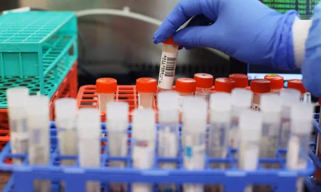 Kinh ngạc: Nhóm y bác sĩ Anh “miễn dịch đặc biệt” với COVID-19 Kinh ngac: Nhom y bac si Anh “mien dich dac biet” voi COVID-19