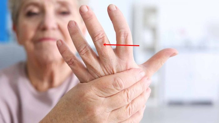 2. Ngón giữa dày hơn và mỏng hơn các ngón còn lại: Chúng ta có thể quan sát xem ngón giữa của mình có hiện tượng như vậy không. Trên thực tế, trong tình trạng cơ thể bình thường thì các ngón tay sẽ có độ dày đều nhau.