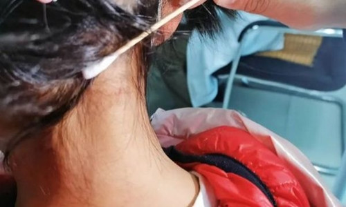 Tuong mun ruoi moi moc, hoa ra ky sinh trung hut mau dang so