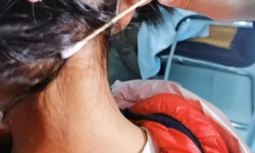 Tuong mun ruoi moi moc, hoa ra ky sinh trung hut mau dang so