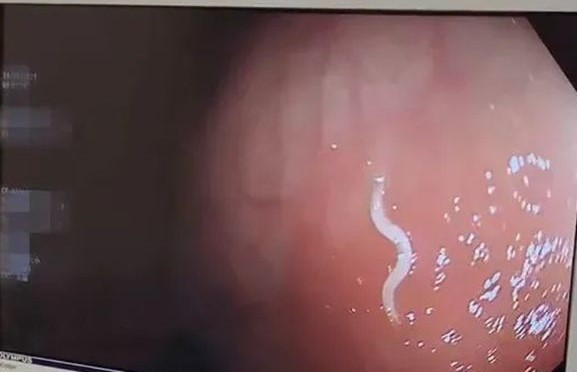 Om thu cung di ngu, thieu nu gap chuyen ghe ron khong ngo