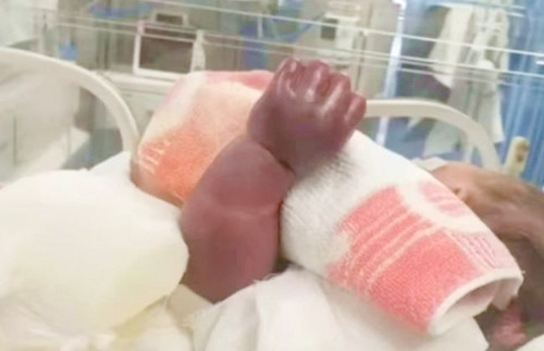 Lam dieu nay voi con so sinh, me suyt khien con cut tay