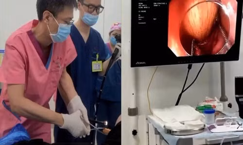 Bi tao bon, chang trai thong ruot bang cach kinh di...nhap vien gap