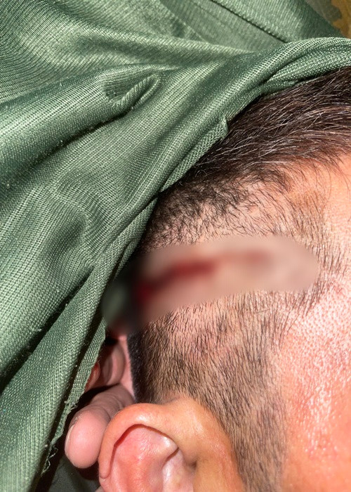 Theo Dân Việt, người thân của Chế Phi cho biết, ngay sau khi sự việc xảy ra, công an đã có mặt tại hiện trường ghi nhận sự việc. Tuy nhiên, do bị thương và say nên nam ca sĩ chưa làm việc được với cơ quan chức năng. Ảnh: Công an TP HCM