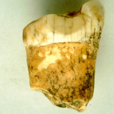 Các nhà nghiên cứu đã thử phân tích đồng vị nitơ từ collagen xương trong một chiếc răng hàm Neanderthals cổ đại. Tỉ lệ giữa 2 đồng vị nitơ-14 và nitơ-15 sẽ tiết lộ sự thật. Nitơ-15 cao hơn nitơ chứng tỏ đó là loài chủ yếu ăn thịt, tuy nhiên một số loài thực vật có quá nhiều nitơ-15 ở một số vùng trên Trái Đất có thể gây nhiễu loạn kết quả.