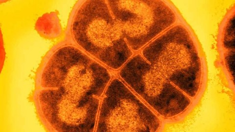 Deinococcus radiodurans được nhà nghiên cứu Arthur Anderson tại Trạm Thí nghiệm Nông nghiệp Oregon (Mỹ) phát hiện năm 1956 trong một hộp thịt.