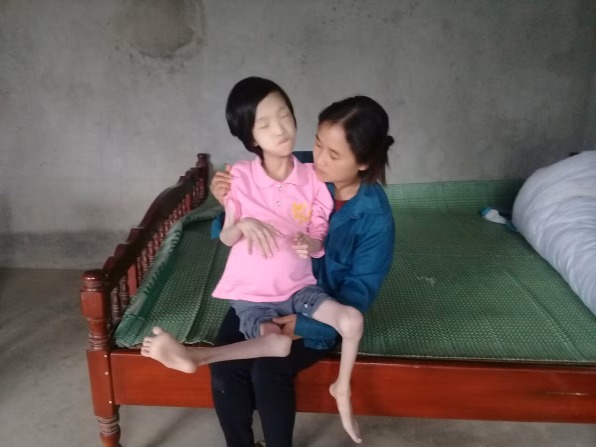 Phu Tho: Xot thuong chau be ngheo bi da di tat chan tay co quap-Hinh-2