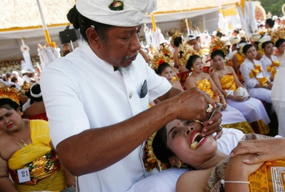 Mài răng trong đám cưới ở Bali, Indonesia: Ít ai biết rằng ở Bali có một nghi lễ đám cưới khác thường. Trước lễ ăn hỏi, cô dâu chú rể có tục lệ giũa 6 chiếc răng. Vào đêm trước đám cưới, cặp vợ chồng mới cưới sẽ cạo cả hai cặp răng cửa, cũng như răng nanh.