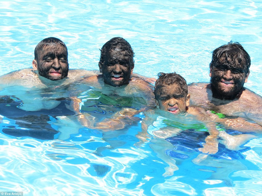 Jesus Aveves (ngoài cùng bên trái), ở thành phố Loreto, Mexico, chào đời với hội chứng Người sói (Ambras) - một căn bệnh hiếm khiến lớp lông dày phủ kín khuôn mặt anh. Khi Jesus làm việc tại công trường xây dựng ở Mexico, anh bị những kẻ lạ mặt la ó và chế giễu. Ảnh: EA.