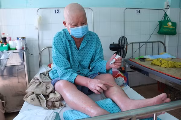 Stress vì mất việc mùa dịch, nhiều người TPHCM “mọc vảy” khắp cơ thể - Hình 2 Stress vi mat viec mua dich, nhieu nguoi TPHCM “moc vay” khap co the-Hinh-2