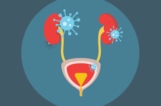 Nguyên nhân phổ biến nhất của bệnh là do vi khuẩn Escherichia coli. Tuy nhiên, các loại vi khuẩn hay các loài nấm khác cũng có thể là "thủ phạm". Ảnh: HC.