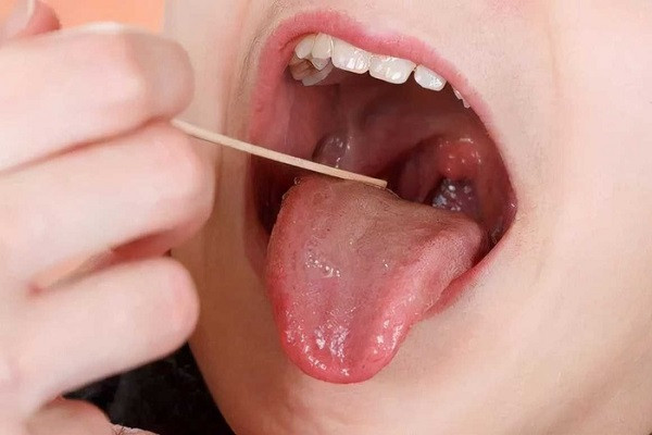 Hoi tho con co mui, me dua di kham...gap ra hat dang so