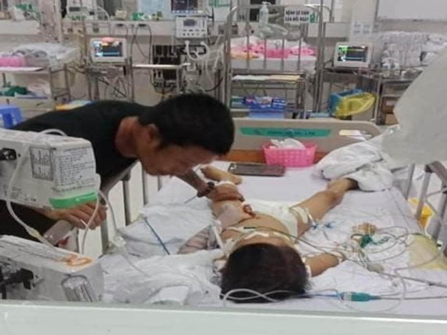 Be 7 tuoi hon me sau sau mo lay dinh nep xuong da mat