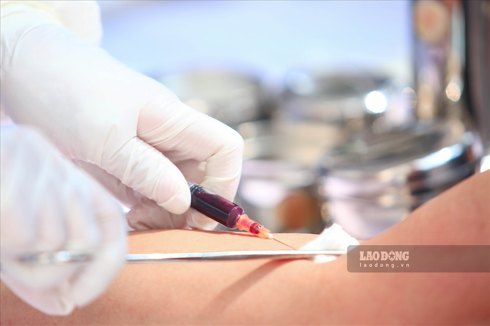 Cũng theo bác sĩ Phương Anh, đối với những phường có đông công dân thuộc diện cần test nhanh sẽ được tiến hành lấy mẫu nhanh tại phường. Sau 10 phút sẽ có kết quả trả cho công dân.Trong số 30/31 trường hợp công dân đi từ Đà Nẵng về có dấu hiệu ho sốt đã có kết quả âm tính, 1 trường hợp đang chờ kết quả xét nghiệm.