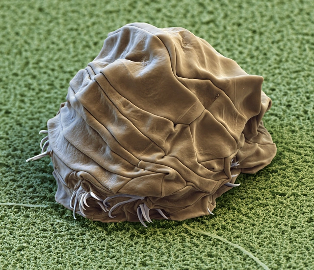 Ở nhiệt độ khắc nghiệt của gấu nước cũng được hưởng lợi từ cơ chế sửa chữa DNA mạnh mẽ của chúng. Khi DNA của tế bào bị hư hỏng, tardigrades có thể nhanh chóng sửa chữa các lỗi trong DNA và tránh chết tế bào.