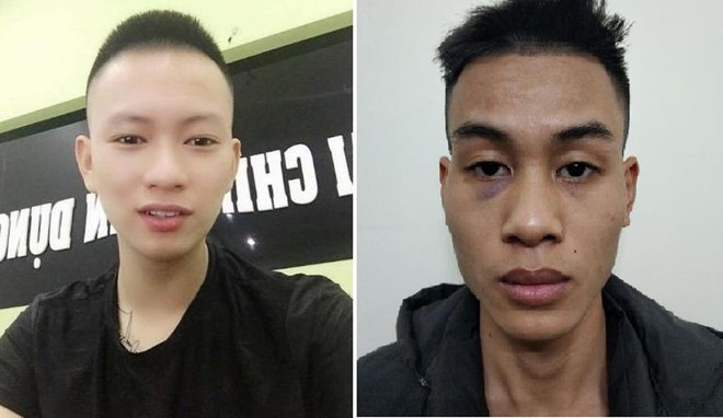  Dùng kiếm và điếu cày đánh hai bố con “con nợ”: Do không cầm đủ tiền nên anh Nghĩa ở TP Hạ Long (Quảng Ninh) gọi bố là ông Lưu Đình A. cầm tiền đến trả nợ. Thấy ông A. đến, Đinh Văn Xuyên (SN 1998, trú tại huyện Gia Lộc, tỉnh Hải Dương) dùng thanh kiếm bằng kim loại còn Phan Hoàng Sinh (SN 2002, trú tại phường Hà Phong, TP Hạ Long) dùng chiếc điếu cày bằng tre để đánh anh Nghĩa và ông A. Hôm nay, Công an TP Hạ Long đã khởi tố bị can 2 đối tượng này về hành vi “Gây rối trật tự công cộng”. 