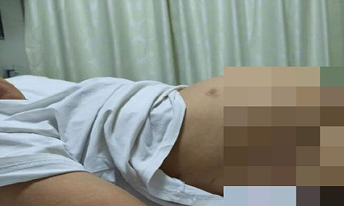 Nu sinh tuong minh co dang dep, nao ngo mac benh hiem