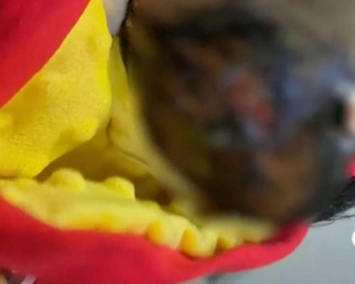 Tam sai cach, nu y ta khien be so sinh bong nang da dau