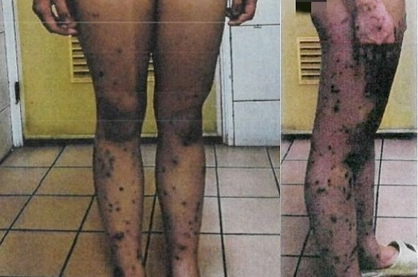 Co gai bi chu dam kim, xat ot vao nguoi nhu thoi trung co-Hinh-2