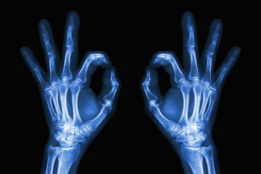 5. Đức có nhiều phát minh quan trọng: Nhiều thiết bị và vật dụng thường ngày được phát minh ở Đức, như máy chụp x-quang, đồng hồ bỏ túi, kẹo dẻo, động cơ dầu diesel, điện thoại, màn hình LCD hay que thử thai. Ảnh: Professionisanitarielavoro.