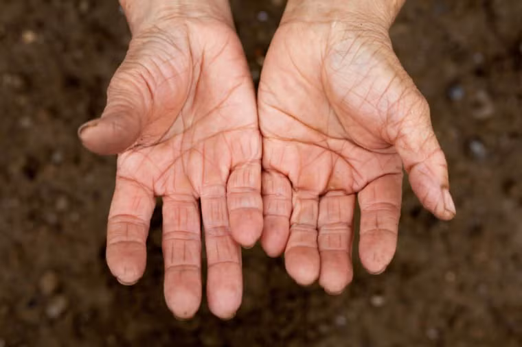 Bàn tay: Đặc biệt ở phụ nữ, bàn tay sẽ là một trong những bộ phận cơ thể đầu tiên mà bạn nhận thấy có dấu hiệu tuổi tác. Sự thay đổi nội tiết tố dẫn đến mất độ đàn hồi của da và giảm thể tích ở mu bàn tay. Những thay đổi này gây ra sự xuất hiện của các tĩnh mạch trở nên rất nổi bật. Bàn tay cũng hình thành các đốm đồi mồi do tiếp xúc với ánh nắng mặt trời, gây lão hóa.