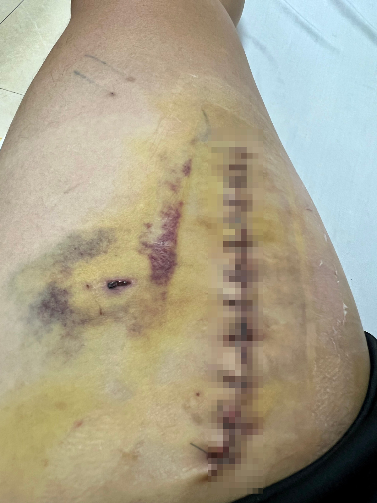 VDV vo thuat tiep tuc de nghi lam ro vu dang di duong bi trung dan-Hinh-2