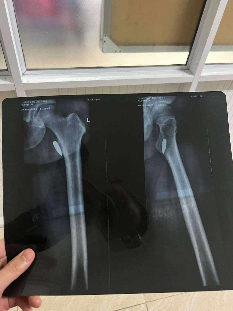 VDV vo thuat tiep tuc de nghi lam ro vu dang di duong bi trung dan-Hinh-3