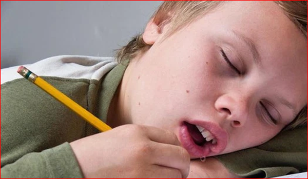 Một nguyên nhân khác dễ dẫn tới tình trạng chảy dãi khi ngủ là thói quen thở bằng miệng. Thở cách này, miệng được mở rộng khiến nước bọt khó giữ lại, dễ bị tiết ra ngoài. 