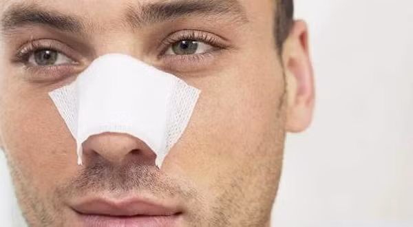 3 to – Mũi to hơn. Cánh mũi phì đại không chỉ khiến diện mạo trở nên xấu xí mà còn phản ánh tình trạng sức khỏe. Sở dĩ cánh mũi nam giới to ra theo thời gian bắt nguồn từ quá trình lão hóa. Khi chúng ta già đi, các mô sụn ở mũi dần mất tính đàn hồi, mũi trở nên tẹt, lỗ mũi ngày càng to.