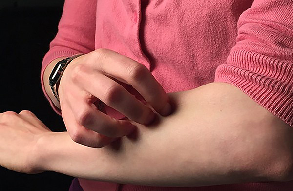 Ngoài nguy cơ tiếp xúc với formaldehyde, quần áo mới mua không giặt có thể chứa lượng lớn thuốc nhuộm còn sót lại. Những hóa chất tổng hợp này rất dễ gây dị ứng.