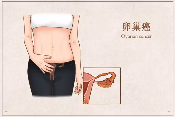 Chi chiet con chua chong da chua, bo me nga quy khi biet nguyen nhan