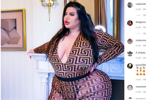 Lo lắng cho sức khỏe của Natasha, bác sĩ từng khuyên cô nên dừng lại trước khi quá muộn. Đặc biệt, nâng mông kiểu Brazil có tỷ lệ tử vong cao nhất trong số các ca phẫu thuật thẩm mỹ tự chọn. Tuy nhiên, có vẻ lời khuyên của chuyên gia khó có thể lay chuyển được mục tiêu đã được cô đặt ra.