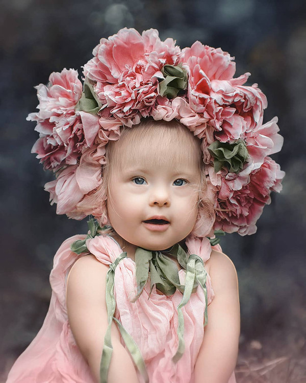 Trong khi đó, nhận nuôi trẻ đặc biệt sẽ dễ dàng hơn nên cặp vợ chồng trẻ quyết định tìm kiếm. Lần đầu đi gặp cô bé mắc hội chứng Down, Katerina “phải lòng” Lisa ngay từ cái nhìn đầu tiên.