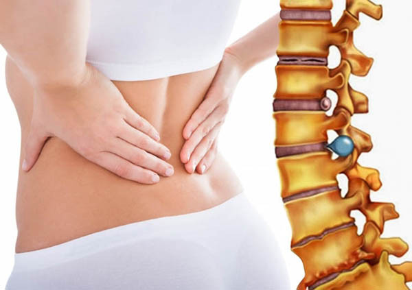 Không chỉ dễ gây viêm âm đạo, Trang Sohu (Trung Quốc) thông tin, thói quen ngồi bắt chéo chân còn làm tăng nguy cơ thoát vị đĩa đệm cột sống, gây đau thắt lưng mạn tính. Thậm chí, đây còn là một trong những yếu tố làm tăng khả năng mắc lạc nội mạc tử cung ở phụ nữ.