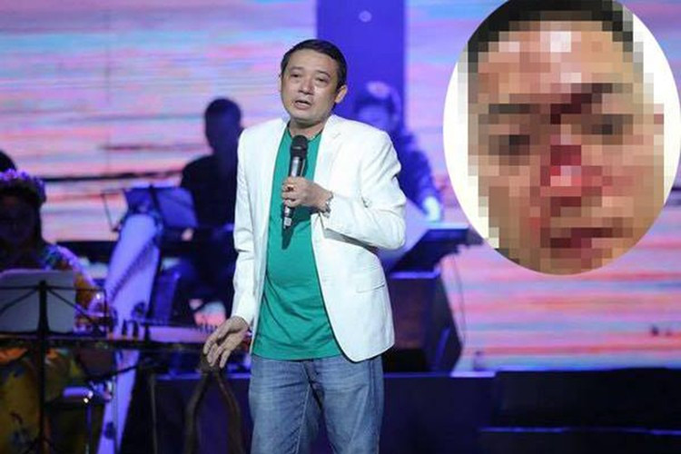 Chiến Thắng từng bị một khán giả sàm sỡ trên sân khấu khi diễn hội chợ ở Hà Giang. Sau đó, người này bị một số vệ sĩ kéo xuống và xảy ra xô xát. Không dừng lại ở đó, người quấy rối Chiến Thắng còn đăng lên mạng xã hội hình ảnh gương mặt đầy máu sau khi xô xát với lực lượng vệ sĩ của hội chợ kèm lời đe dọa nam nghệ sĩ. Ảnh: Vietnamnet.