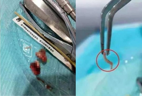 Kham rang, benh nhan khien bac si so chet khiep khi thay 