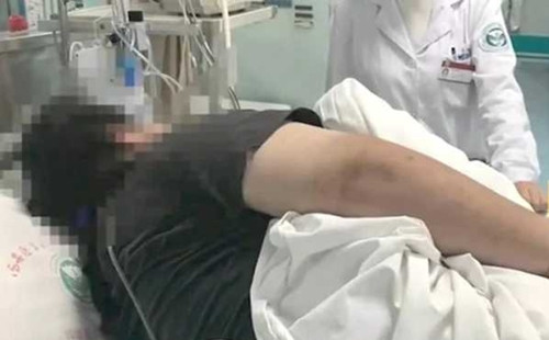 Ngay an 1 bua van nang 130kg, nguyen nhan khien bac si hoang so