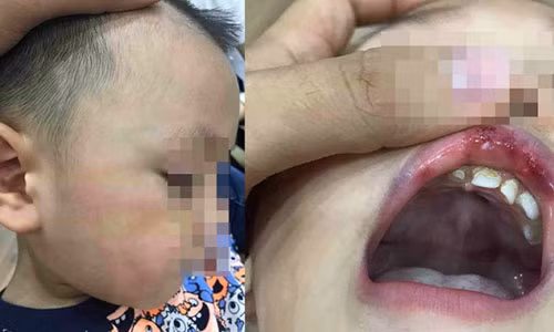 Ha Noi: Co giao mam non Ecokids tat bam ma be trai 3 tuoi