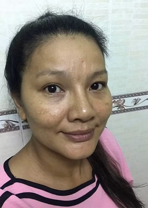 Mới đây, "nữ hoàng cảnh nóng" chia sẻ hình ảnh mặt mộc với làn da đen sạm, tàn nhang khiến khán giả khá sốc.