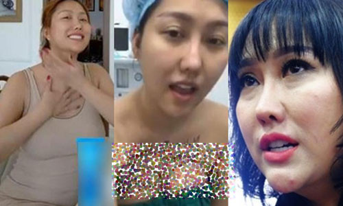 Sao Viet dao keo den bien dang: Con nghien tham my bao gio dung?-Hinh-4