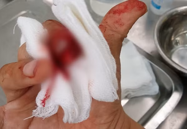 Nhà báo Đỗ Doãn Hoàng đã hô là đánh nhầm người nhưng các đối tượng vẫn dùng gậy vụt liên tiếp vào chân, tay. Khi thấy ông nằm bất động, ba kẻ lạ mặt mới bỏ đi. Ngay sau đó, ông phải nhờ một vài người dân chở ra đường vành đai 3 để bắt taxi đưa đến bệnh viện trong tình trạng nhiều vết bầm tím trên người, một ngón tay bị dập móng, chảy nhiều máu...