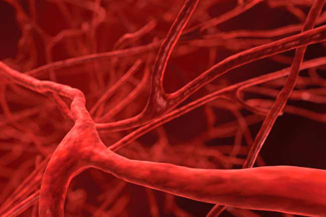 Hội chứng Ehlers – Danlos: Đây là tình trạng dễ chảy máu tiêu biểu. Ở hội chứng này, các vết bầm tím xuất hiện do sự yếu đi của các mao dẫn và mạch máu xung quanh các mô liên kết. Hội chứng này gây bầm tím diện rộng, chậm lành các vết thương hở, thậm chí vỡ động mạch dẫn đến xuất huyết trong nghiêm trọng hoặc tử vong./.