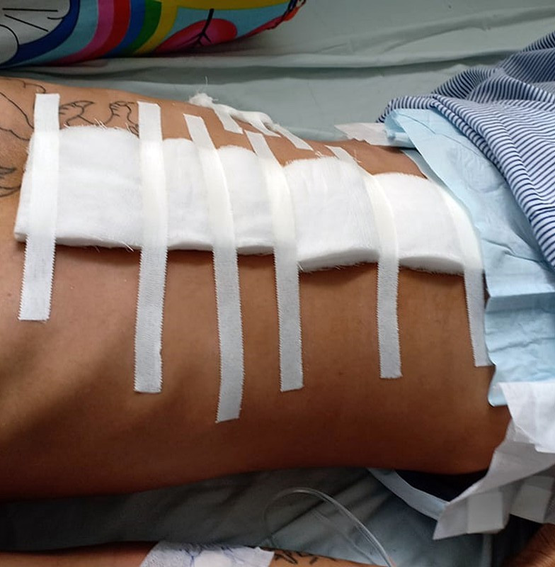 Giang hồ Hùng Sứt cùng đàn em nổ súng bắn 4 người bị thương Giang ho Hung Sut cung dan em no sung ban 4 nguoi bi thuong