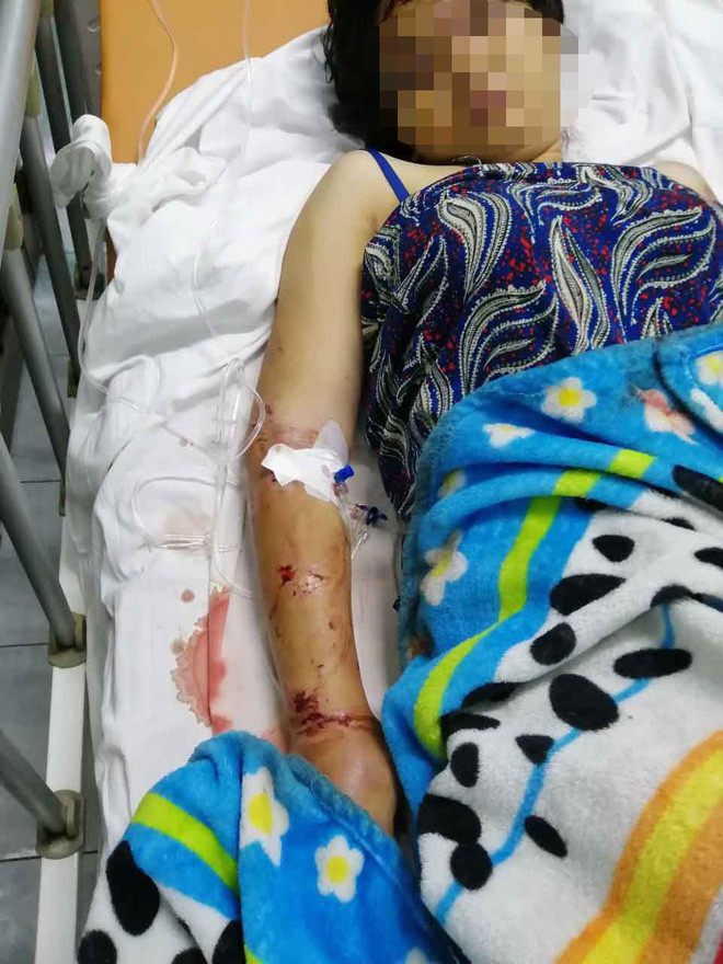 Ba bau bi 2 anh em ruot tra tan suot 2 tuan toi say thai-Hinh-2