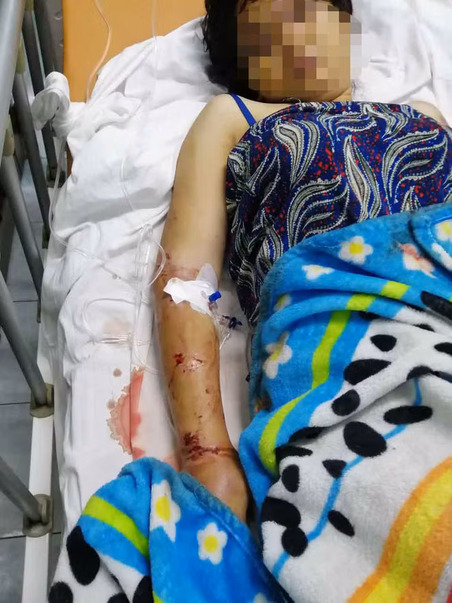 Ba bau bi 2 anh em ruot tra tan suot 2 tuan toi say thai-Hinh-2