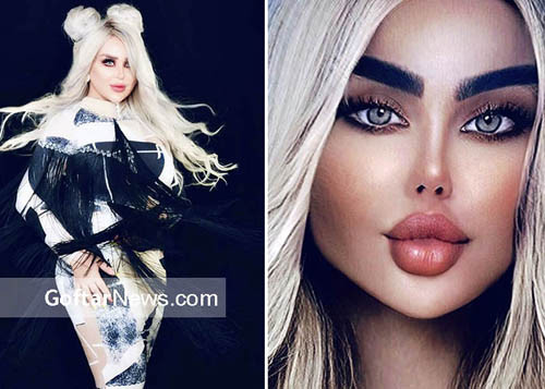 Được biết, Dalia vốn là người dẫn chương trình, diễn viên khá được mến mộ tại quê nhà. Trước khi phẫu thuật thẩm mỹ, cô nàng sở hữu gương mặt ưa nhìn dù các đường nét không quá nổi bật. (Ảnh: Brightside, IGNV)