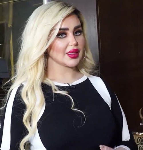 Về phần mình, Dalia không quan tâm đến những ý kiến tiêu cực. Cô vẫn theo đuổi hình ảnh búp bê sống nhưng không còn hài lòng với các cơ sở thẩm mỹ trước đó. Hiện Dalia đang tìm kiếm những phòng khám quốc tế uy tín để giúp cô tiến gần hơn với giấc mơ.