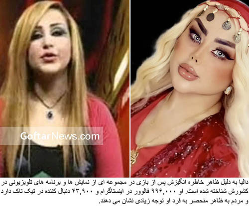 Tuy nhiên, trái với sự tự hào của Dalia, nhiều người cảm thấy khó hiểu vì sao cô lại bỏ ra số tiền lớn để đường nét gương mặt trở nên phóng đại như vậy.