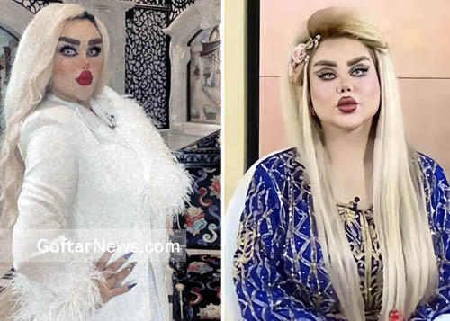 Trong vài tháng, Dalia liên tục trùng tu nhan sắc. Thủ thuật cô thực hiện nhiều nhất là tiêm chất làm đầy ở má, môi, cằm,... để có được làn da căng mọng như những mẫu búp bê Barbie thường thấy. Đồng thời, cô cũng phải nhờ cậy dao kéo để khuôn ngực trở nên đầy đặn hơn.